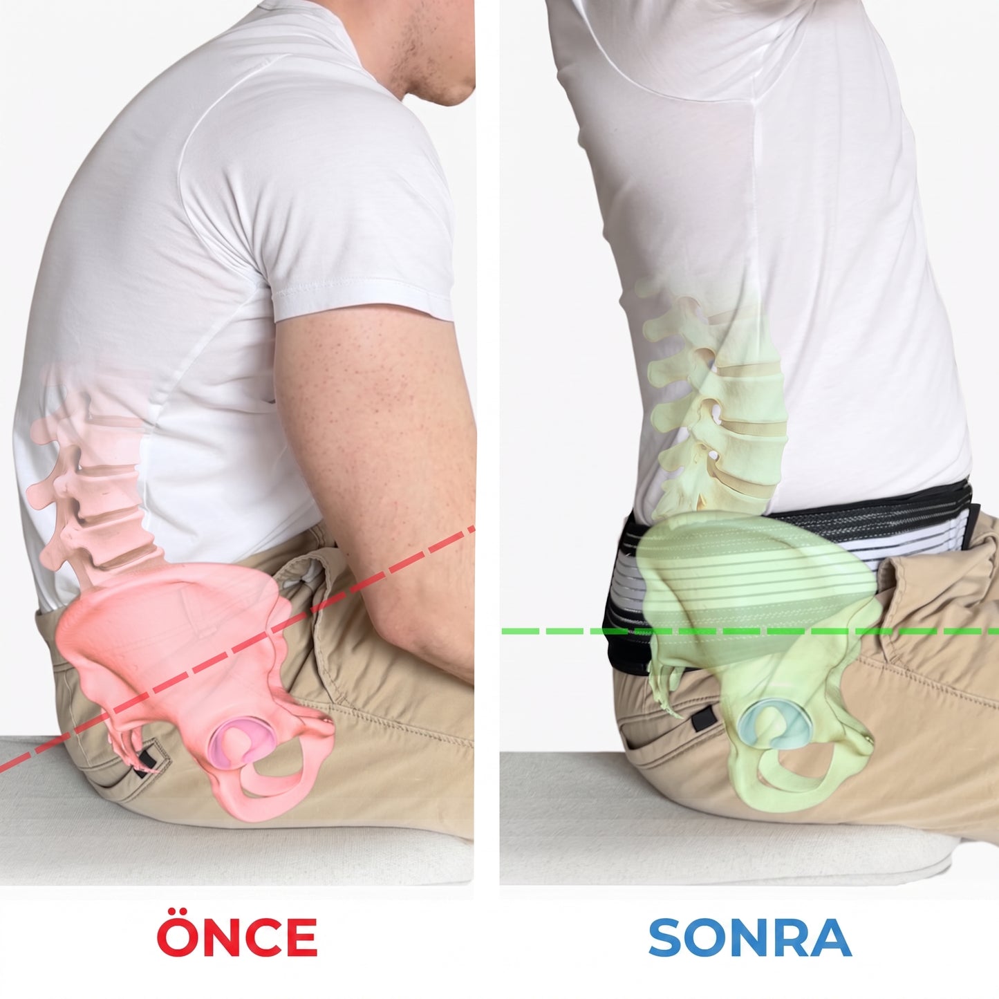 Ortomedi™ Ortopedik Kemer